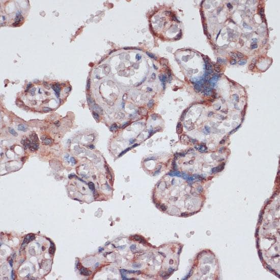RPS13 / Ribosomal Protein S13 Antibody