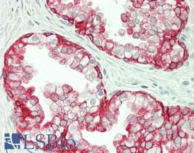 IHC-plus™ KRT16 / CK16 / Cytokeratin 16 Antibody (clone 7A4)