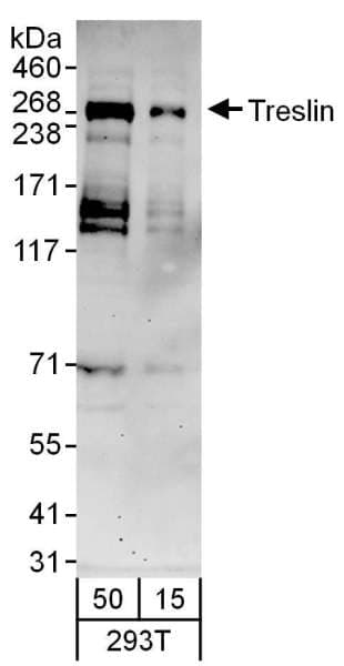 TICRR Antibody (aa975-1025)