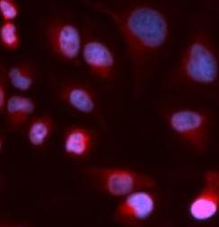 WC1 / ATP7B Antibody