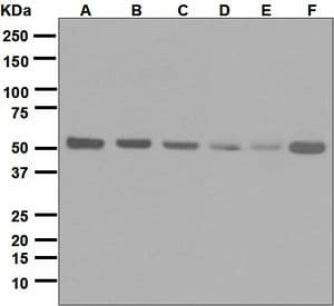 Monoclonal Rabbit anti-Human RXTA / RXR-Alpha Antibody (clone EPR7106, N-Terminus, WB)