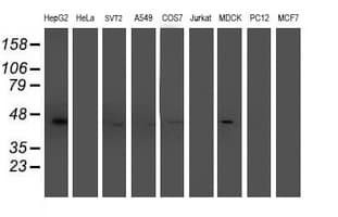 ACY1 / Aminoacylase 1 Antibody (clone OTI2F1)