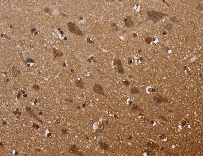 FANCF Antibody