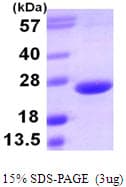 Human TNFSF15 / TL1A / VEGI Protein (Recombinant His)
