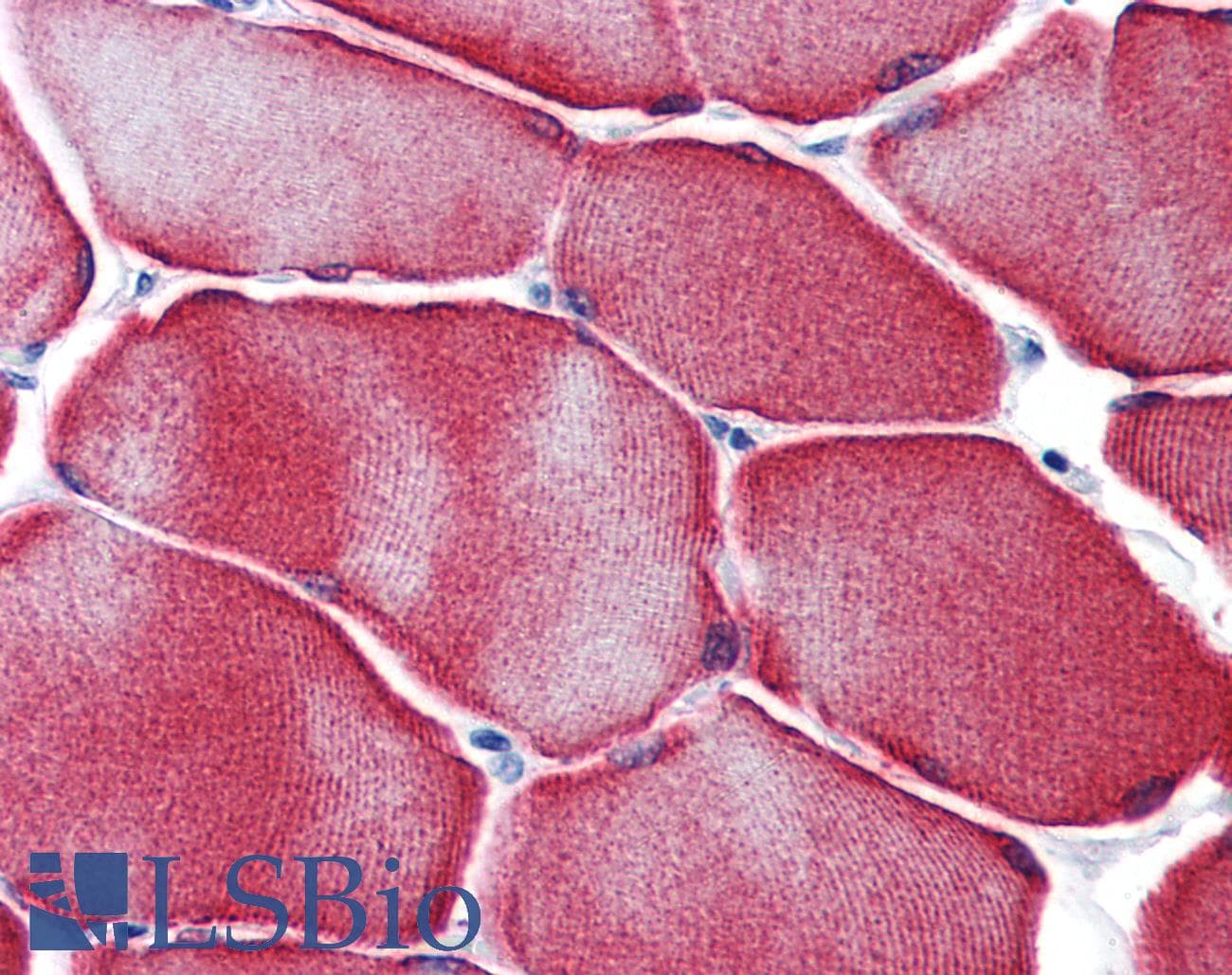 IHC-plus™ Monoclonal Mouse anti-Human HSPB7 / CvHSP Antibody (clone 3E11, IHC, WB)