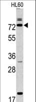 Polyclonal Rabbit anti-Human CAPN9 / Calpain 9 Antibody (aa49-78, WB)