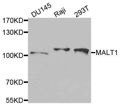MALT1 Antibody