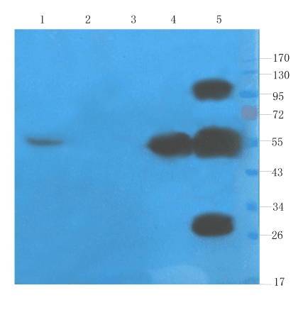 TNF Alpha Antibody (TNF alpha, clone CDP 571 (Humicade))