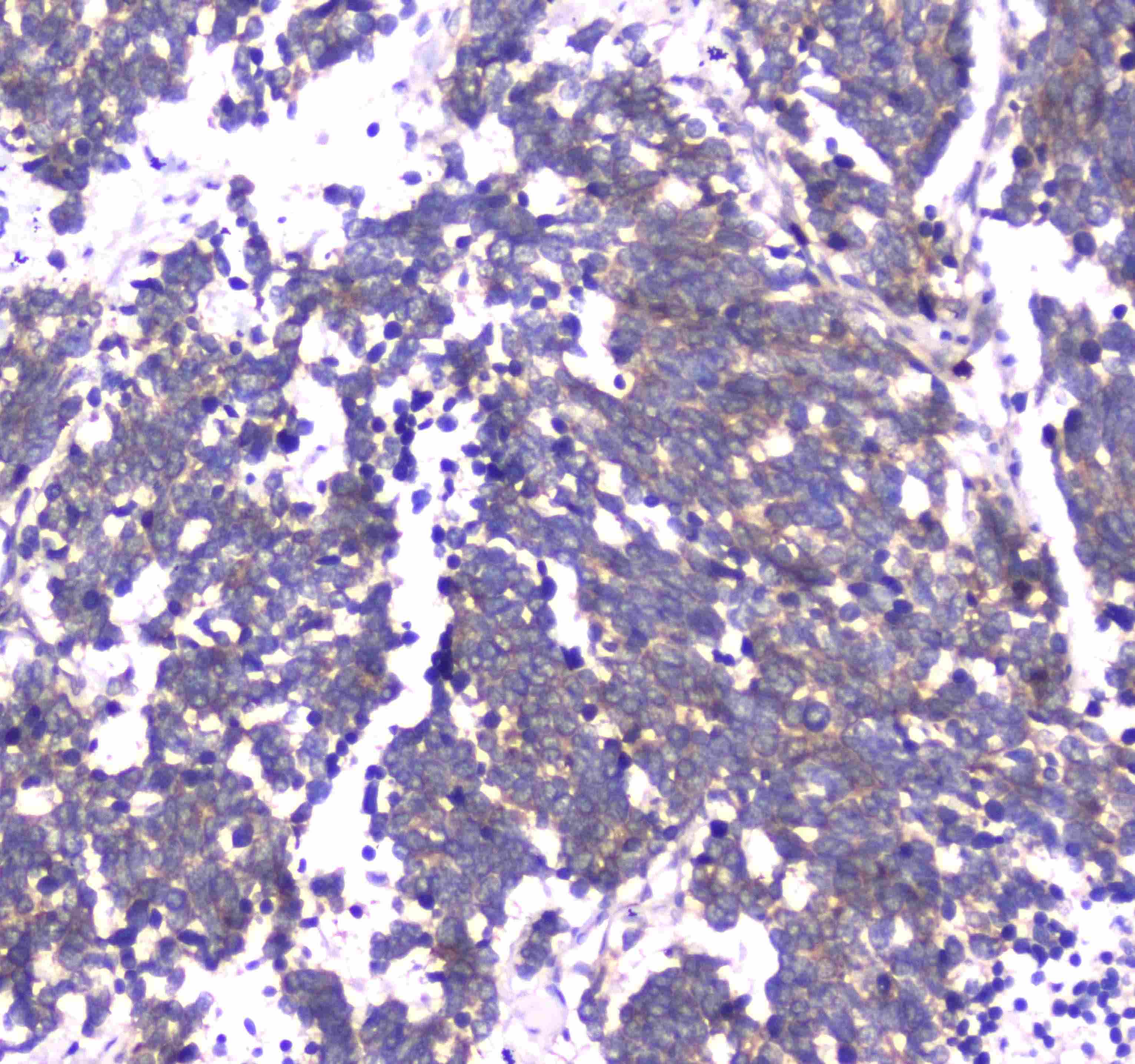 Polyclonal Rabbit anti-Human RAB27A / RAB27 Antibody (IHC, WB)
