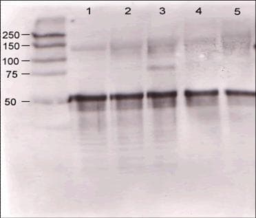 IHC-plus™ Polyclonal Rabbit anti-Mouse ANGPT1 / Angiopoietin-1 Antibody (aa15-45, IHC, WB)