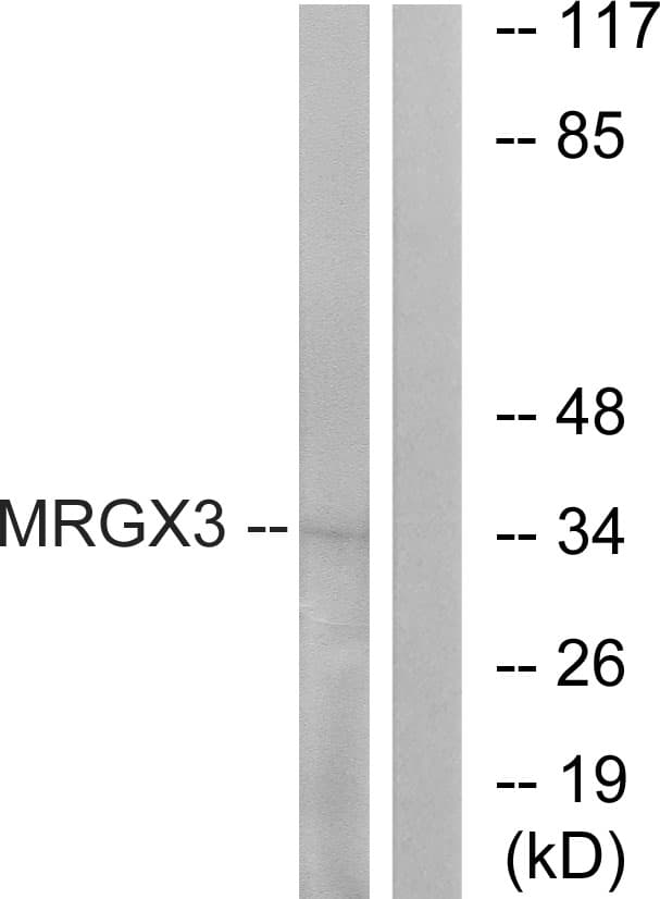 MRGPRX3 / MRGX3 Antibody (aa99-148)