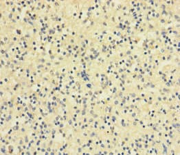 Polyclonal Rabbit anti-Human RETN / Resistin Antibody (aa19-108)