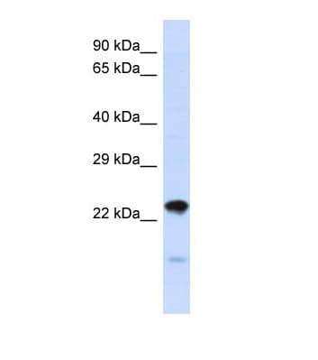 NIPSNAP3A Antibody (aa51-100)