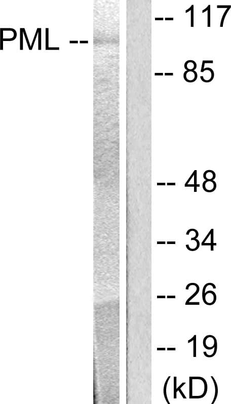 PML Antibody (aa11-60)