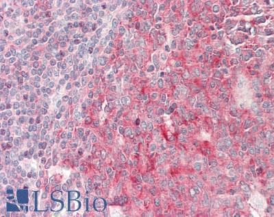 IHC-plus™ Polyclonal Rabbit anti-Human Neurofibromin / NF1 Antibody (aa1526-1575, IHC, WB)