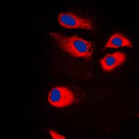 Polyclonal Rabbit anti-Human RPS9 / Ribosomal Protein S9 Antibody (Internal, IF, WB)