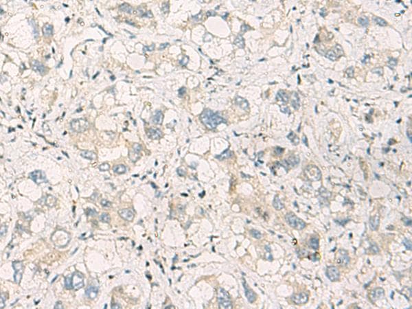 Polyclonal Rabbit anti-Human SPSB2 Antibody (IHC)