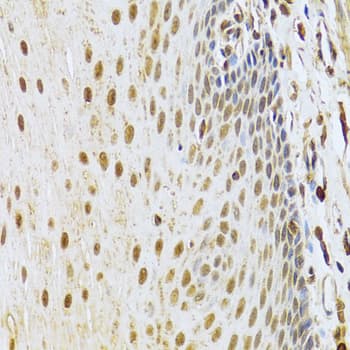 Polyclonal Rabbit anti-Human CDK4 Antibody (IHC, IF, WB)