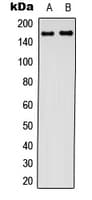 Polyclonal Rabbit anti-Human CFTR Antibody (aa716-755, IHC, WB)