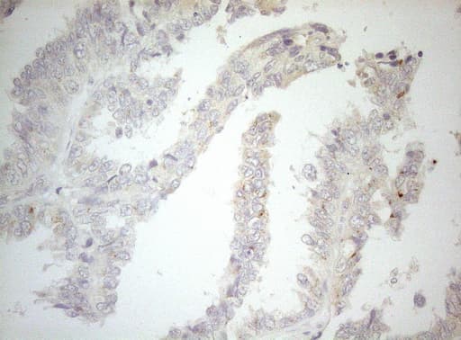 Monoclonal Mouse anti-Human CPM / Carboxypeptidase M Antibody (clone OTI2D11, aa124-423, IHC, WB)