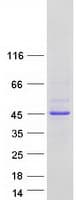 Human MBNL3 Protein (Recombinant Myc-DDK (Flag))