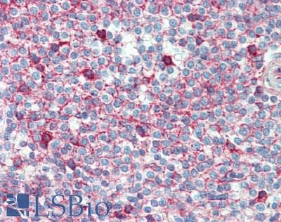 IHC-plus™ SERPINA1 / Alpha 1 Antitrypsin Antibody (N-Terminus)