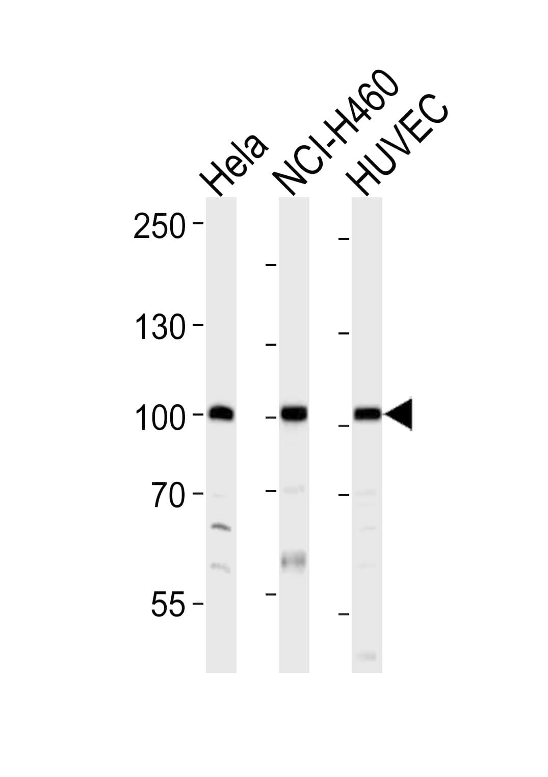 Polyclonal Rabbit anti-Human EPHA4 / EPH Receptor A4 Antibody (aa875-904, IHC, WB)
