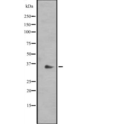 Polyclonal Rabbit anti-Human RAD1 Antibody (WB)