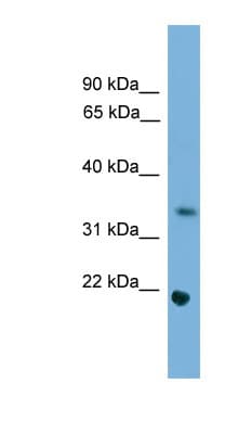 Polyclonal Rabbit anti-Mouse SOHLH1 Antibody (aa121-170, WB)