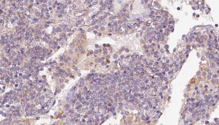 Polyclonal Rabbit anti-Human STAU1 / Staufen Antibody (IHC, IF, WB)