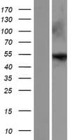 ENTPD8 Protein (Over-Expression Lysate Myc-DDK (Flag))