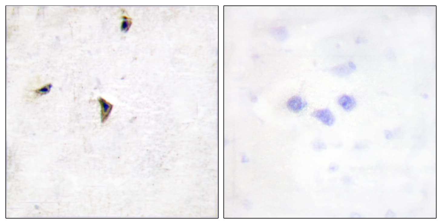 Polyclonal Rabbit anti-Human KCNB1 / Kv2.1 Antibody (aa533-582, IHC, IF)
