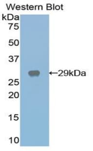 CST / GAL3ST1 Antibody (aa215-423)