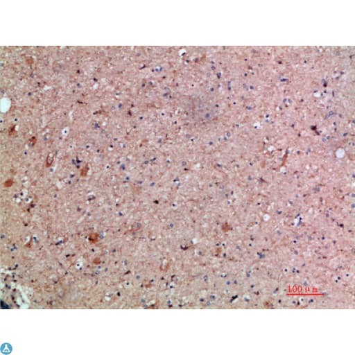 MED1 / TRAP220 Antibody