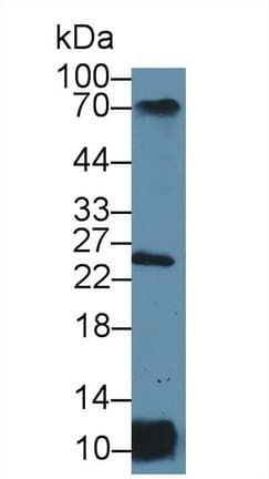 HLA-DRA Antibody (aa27-216, PE)