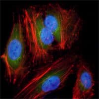 MAP2K2 / MKK2 / MEK2 Antibody (clone 7F5)