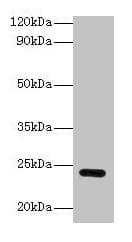 GSTP1 / GST Pi Antibody