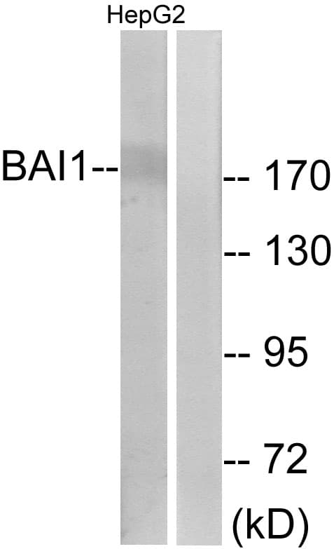 Polyclonal Rabbit anti-Human ADGRB1 / BAI1 Antibody (aa691-740, IHC, IF, WB)
