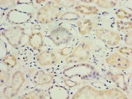 Polyclonal Rabbit anti-Human KLF3 Antibody (aa1-240, IHC)