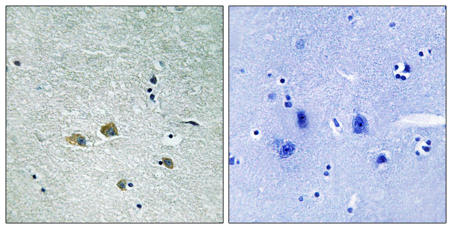 PAK1 Antibody (aa170-219)