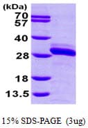 Human RALA / RAL Protein (Recombinant His)