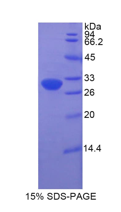 Rat HP / Haptoglobin Protein (Recombinant His-T7)