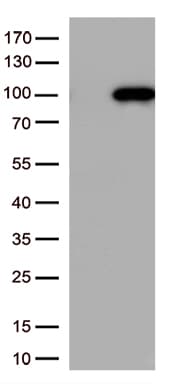 CTNNB1 / Beta Catenin Antibody (clone UMAB15)