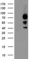 KATNB1 Antibody (clone OTI5H6)