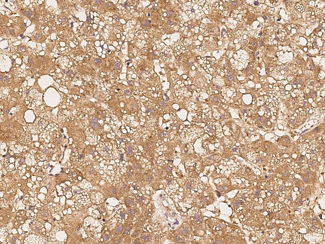 EIF4E Antibody (Preservative Free)