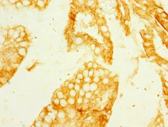 MEP1B Antibody