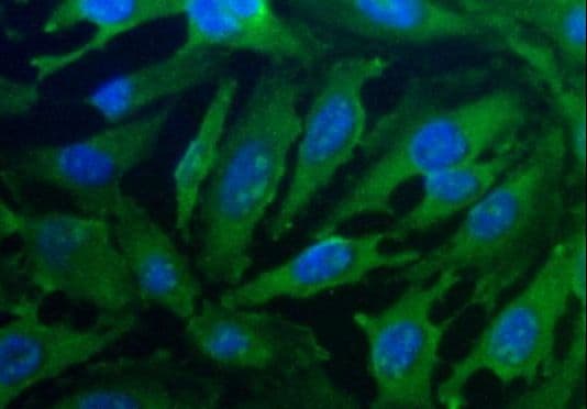 PGAM1 Antibody (aa220-270, Biotin)