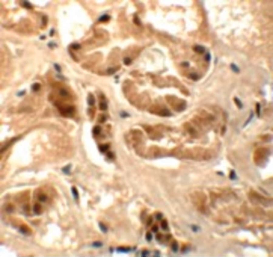 ATAD3B Antibody