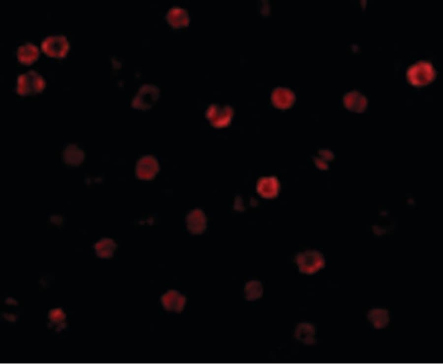IHC-plus™ Polyclonal Rabbit anti-Human CDH13 / Cadherin 13 Antibody (IHC, IF, WB)