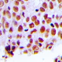 Polyclonal Rabbit anti-Human MSH2 Antibody (Internal, IHC, IF, WB)